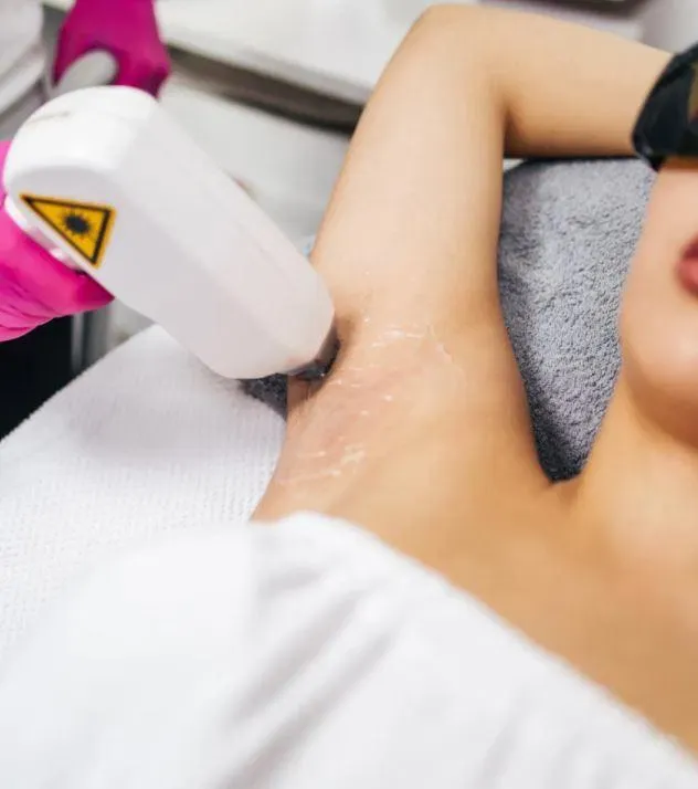 A laser hair removal treatment in progress